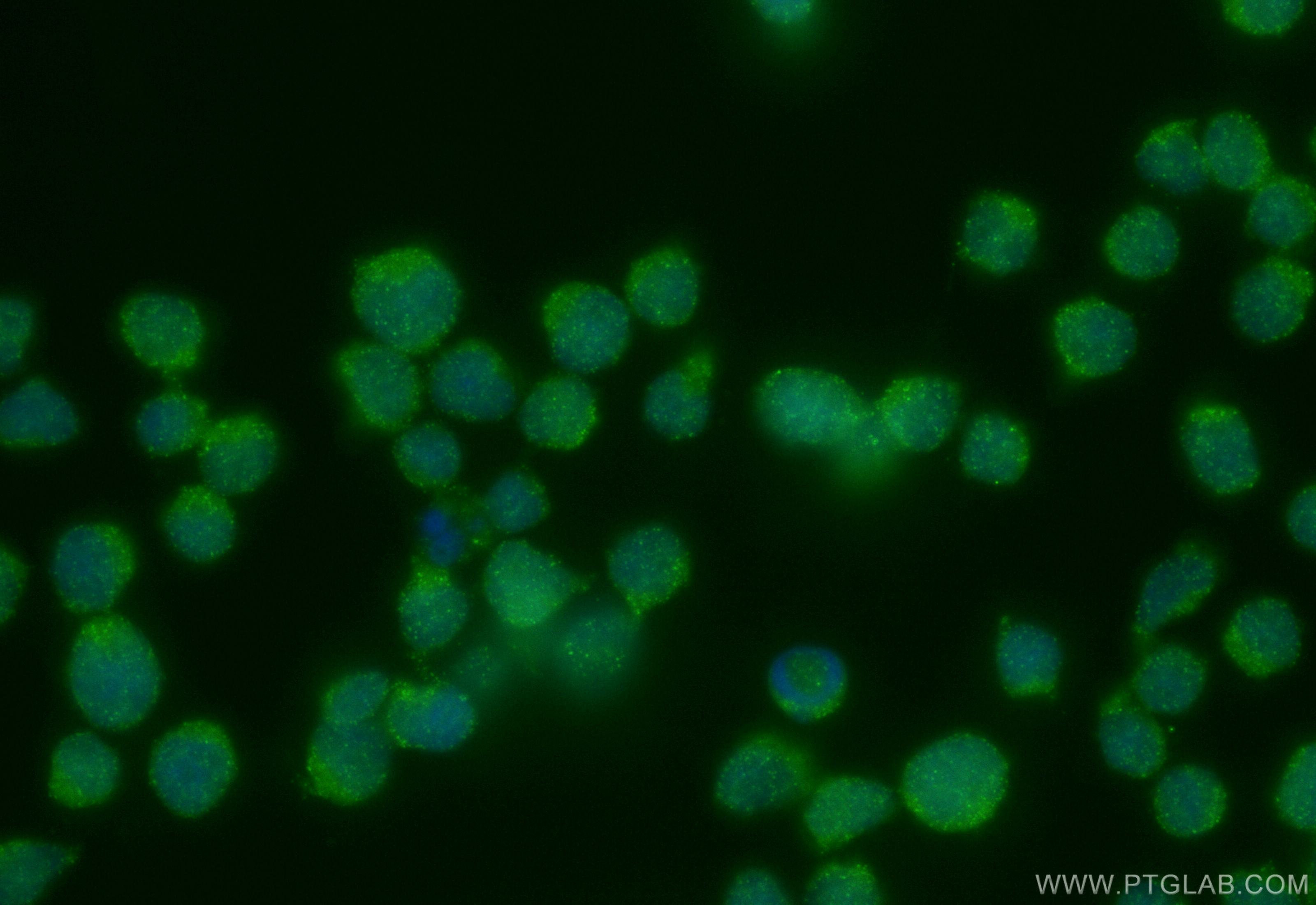 IF Staining of Jurkat using 83606-5-RR