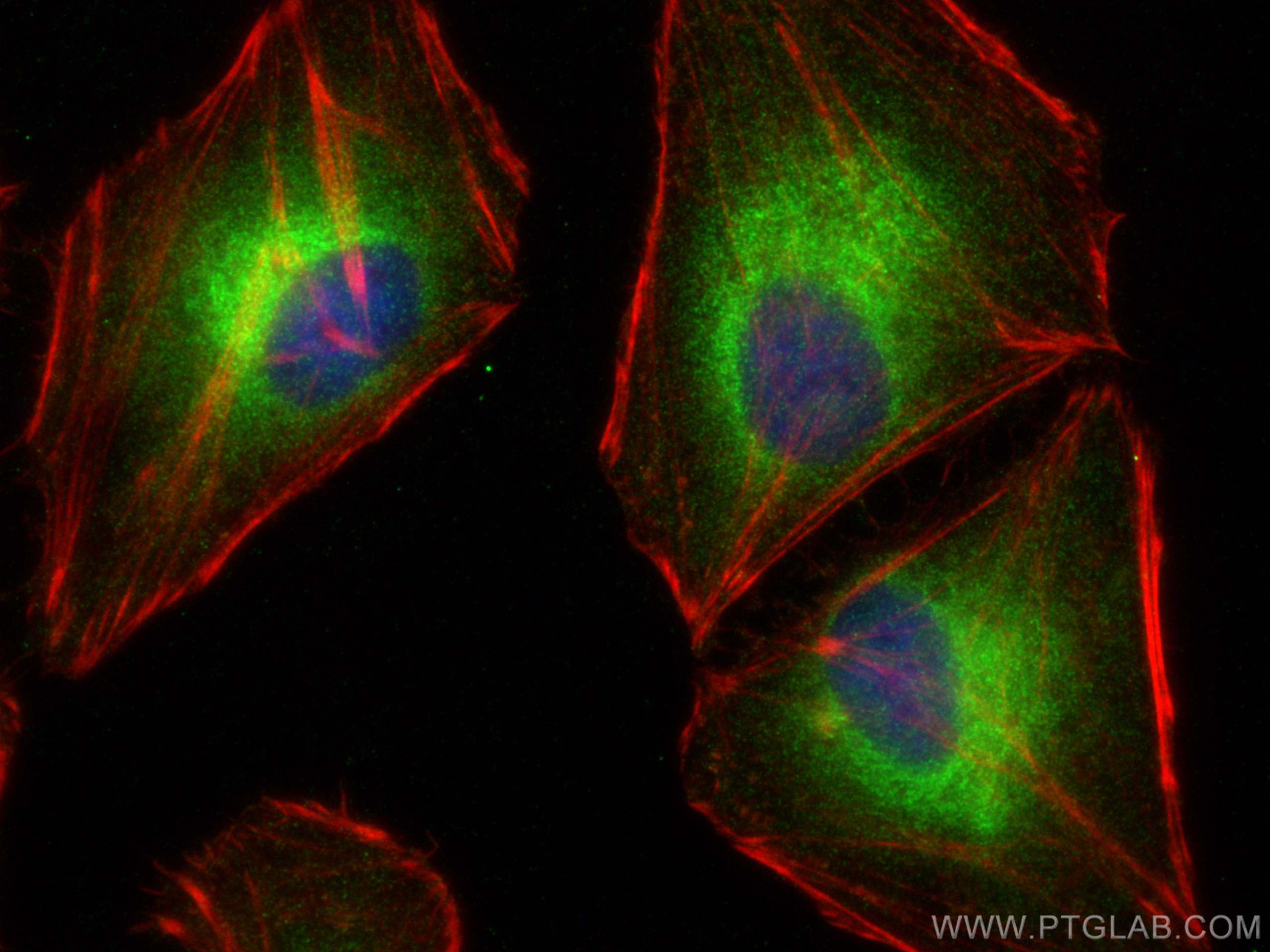 IF Staining of HeLa using 17894-1-AP