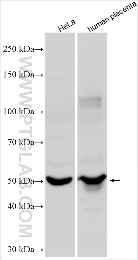 WB analysis using 11818-1-AP