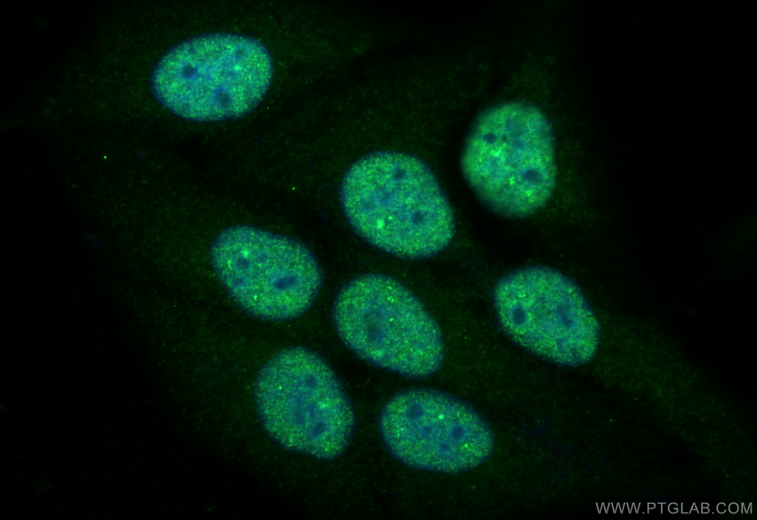 IF Staining of HepG2 using 15789-1-AP