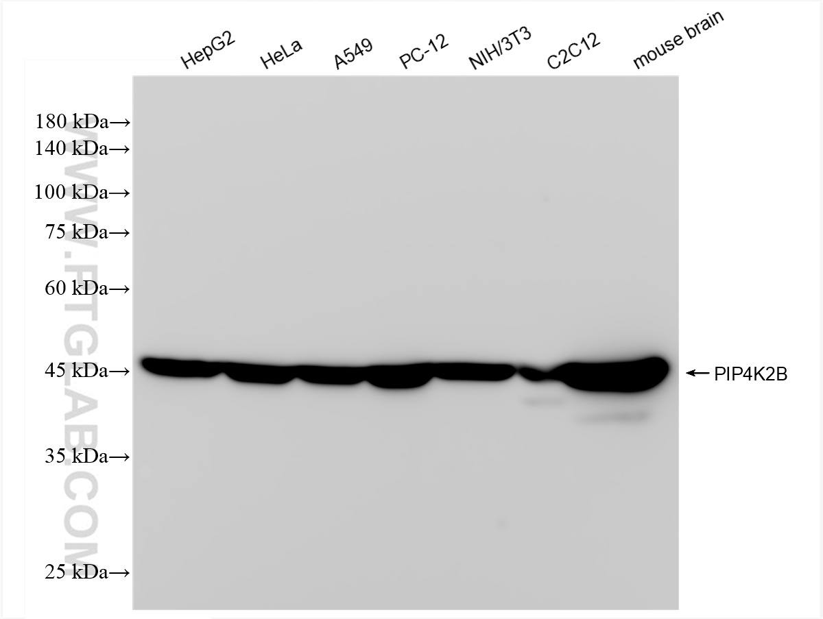 PIP4K2B
