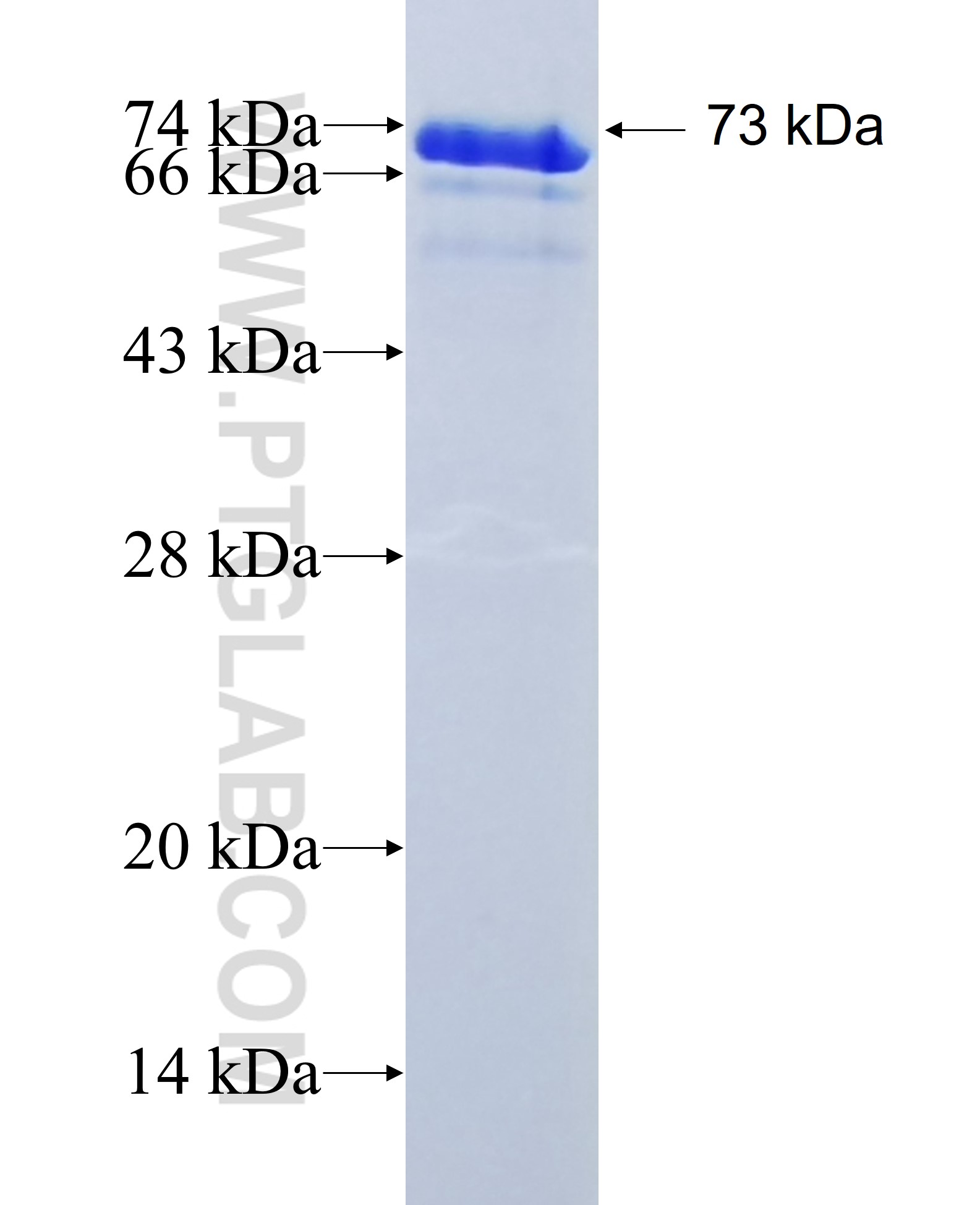 PIP4K2C fusion protein Ag10989 SDS-PAGE