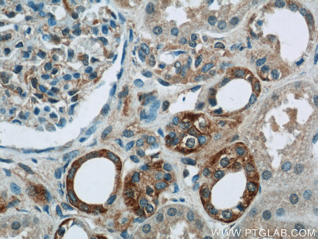 IHC staining of human kidney using 25013-1-AP