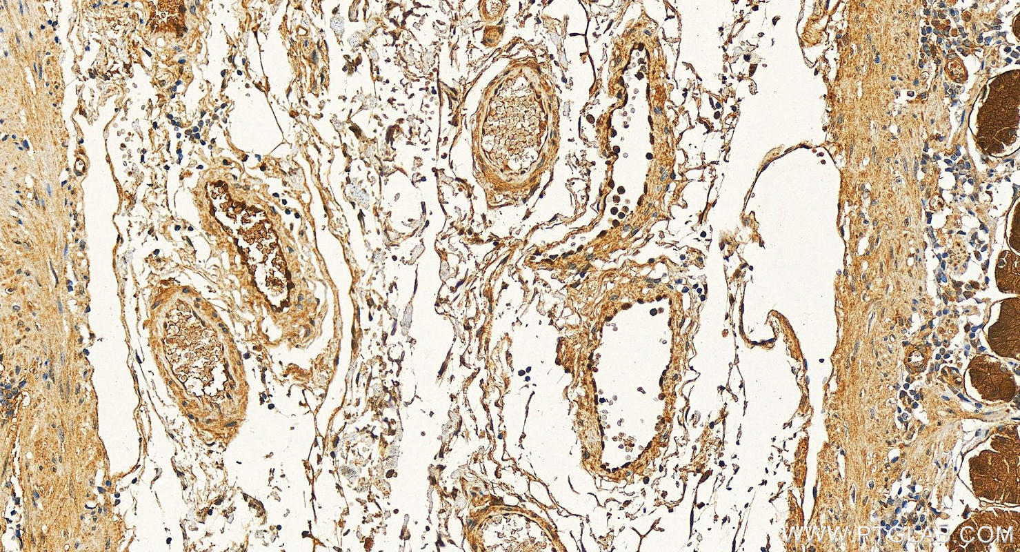 IHC staining of human stomach using 10263-1-AP