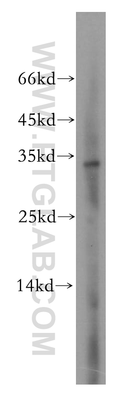 WB analysis of HEK-293 using 16613-1-AP