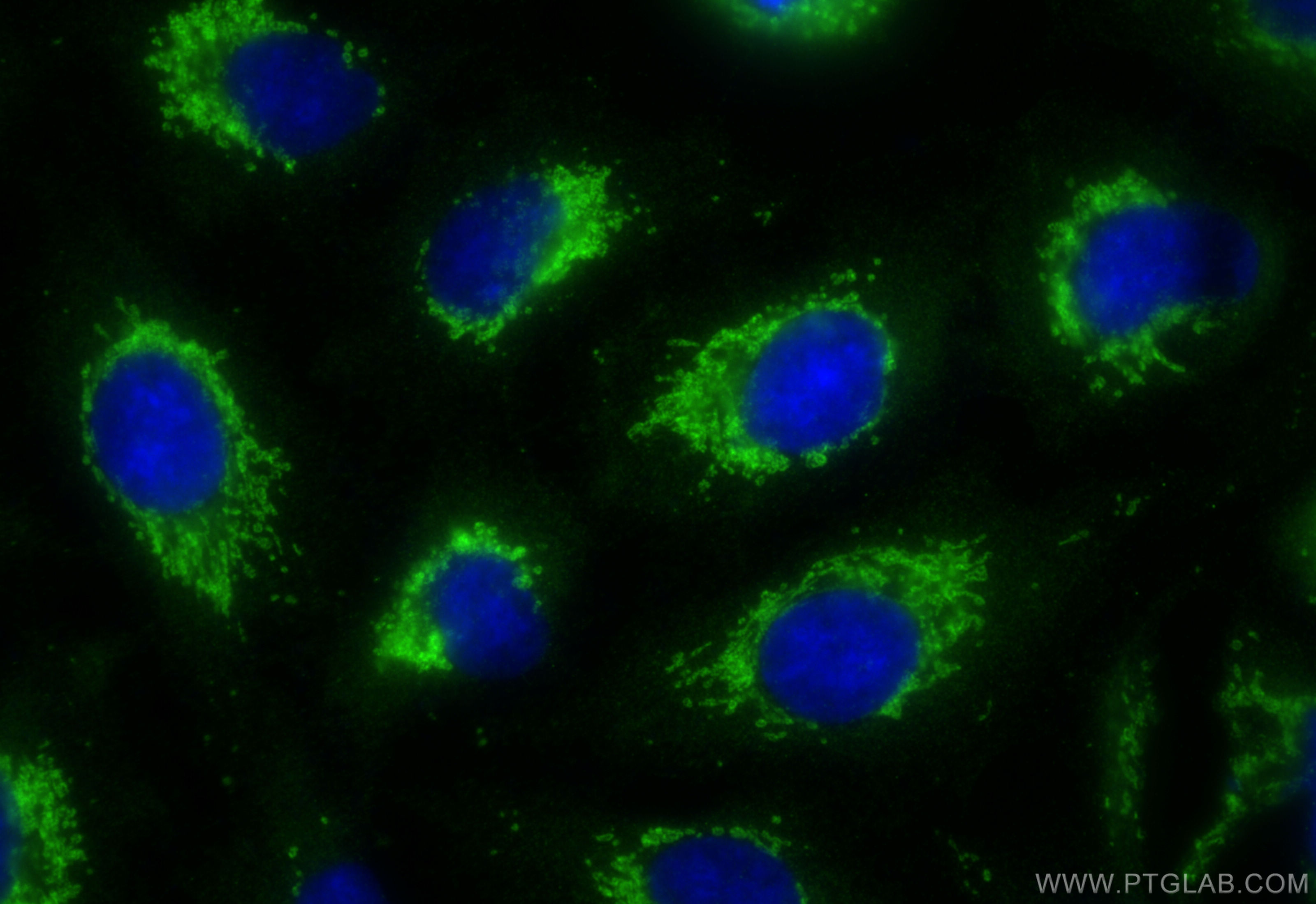 IF Staining of A549 using 10101-2-AP