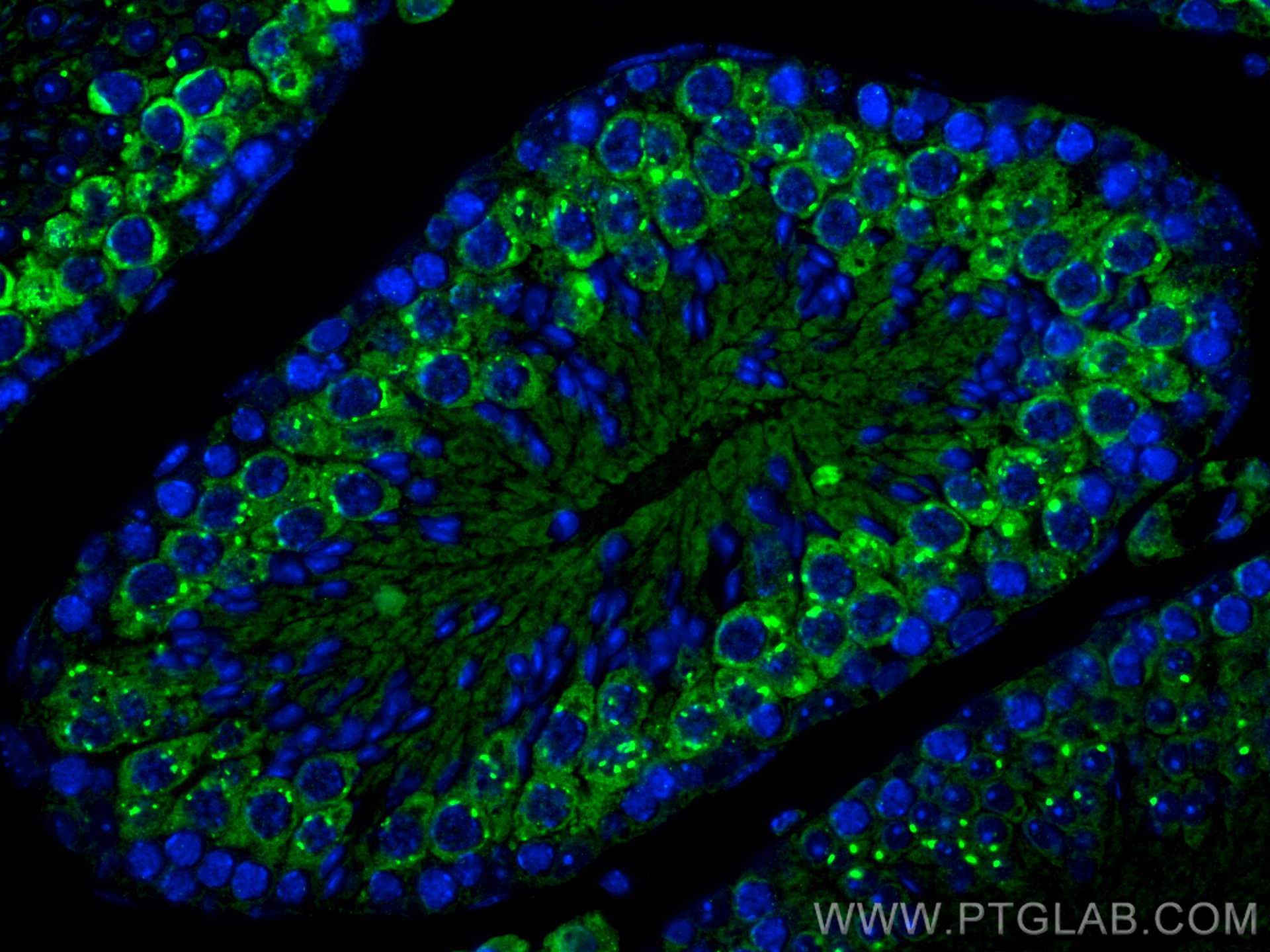 IF Staining of mouse testis using 15659-1-AP