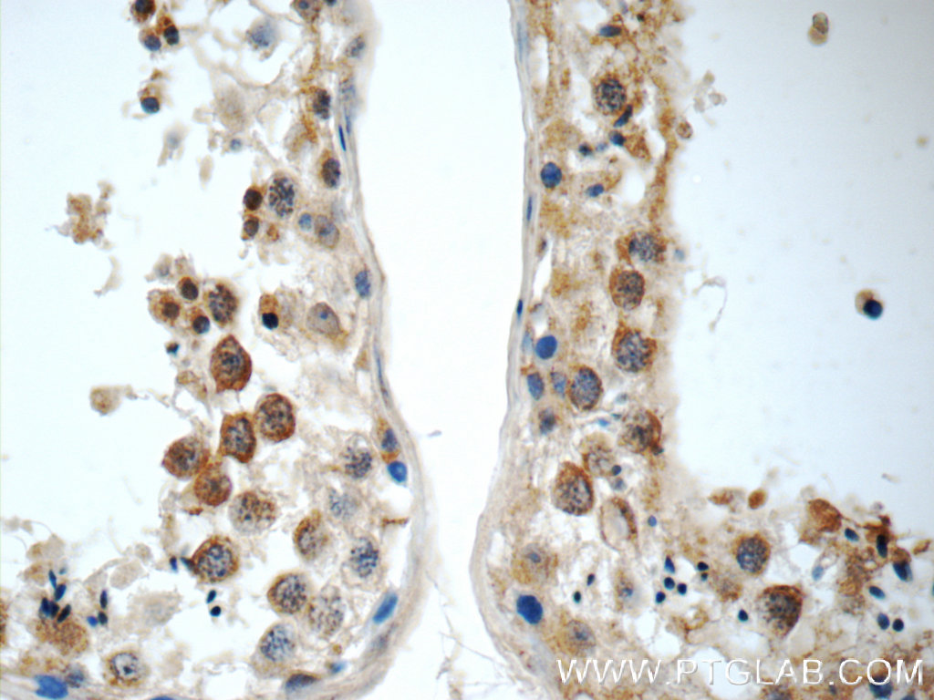 IHC staining of human testis using 15659-1-AP