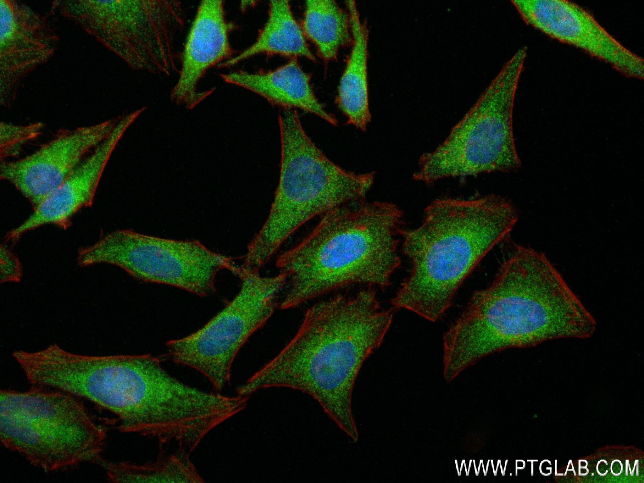 IF Staining of HeLa using 84261-5-RR (same clone as 84261-5-PBS)