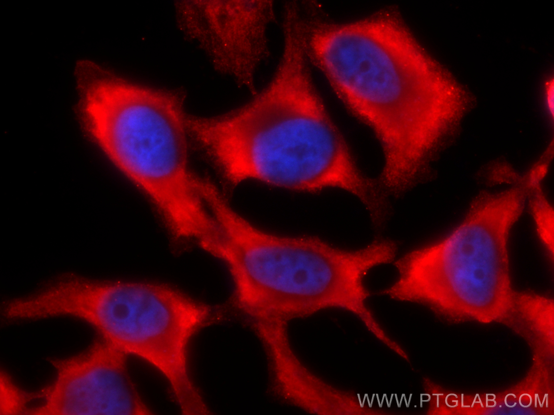 IF Staining of HeLa using CL594-66421