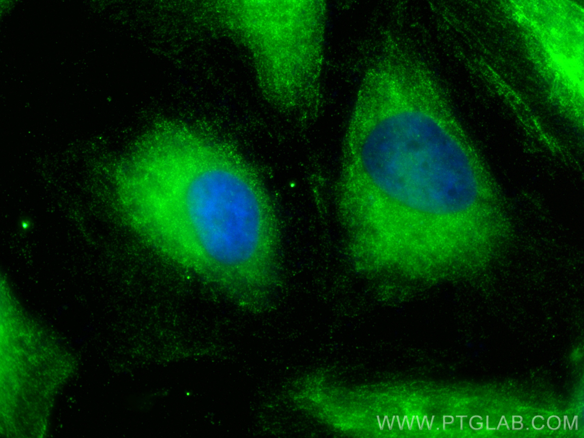 IF Staining of HeLa using 26899-1-AP