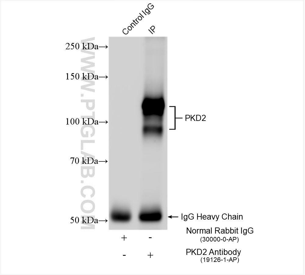 IP experiment of mouse testis using 19126-1-AP