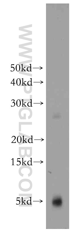 WB analysis of mouse heart using 21371-1-AP