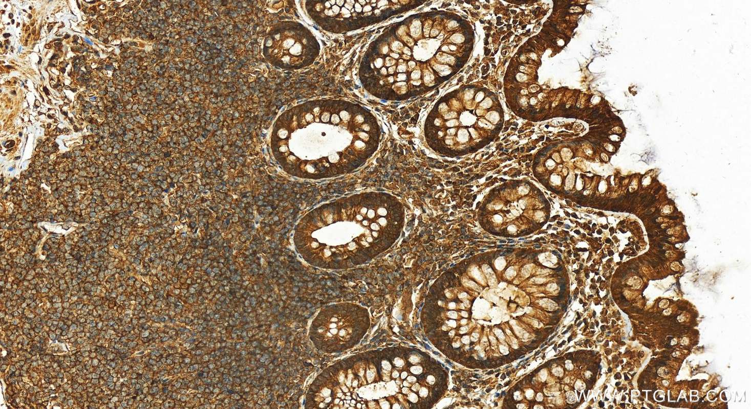 IHC staining of human normal colon using 25659-1-AP