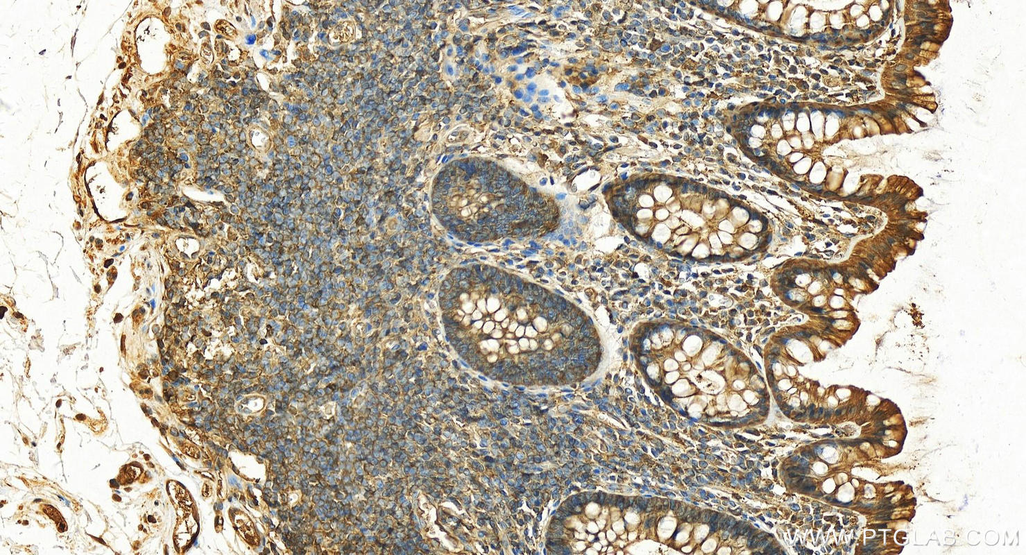 IHC staining of human normal colon using 15822-1-AP