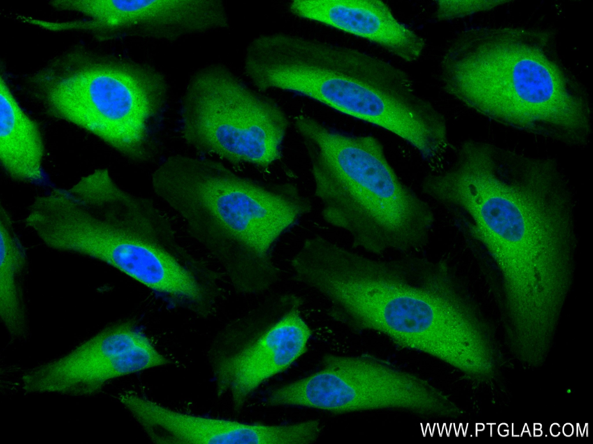 IF Staining of HeLa using 84451-1-RR