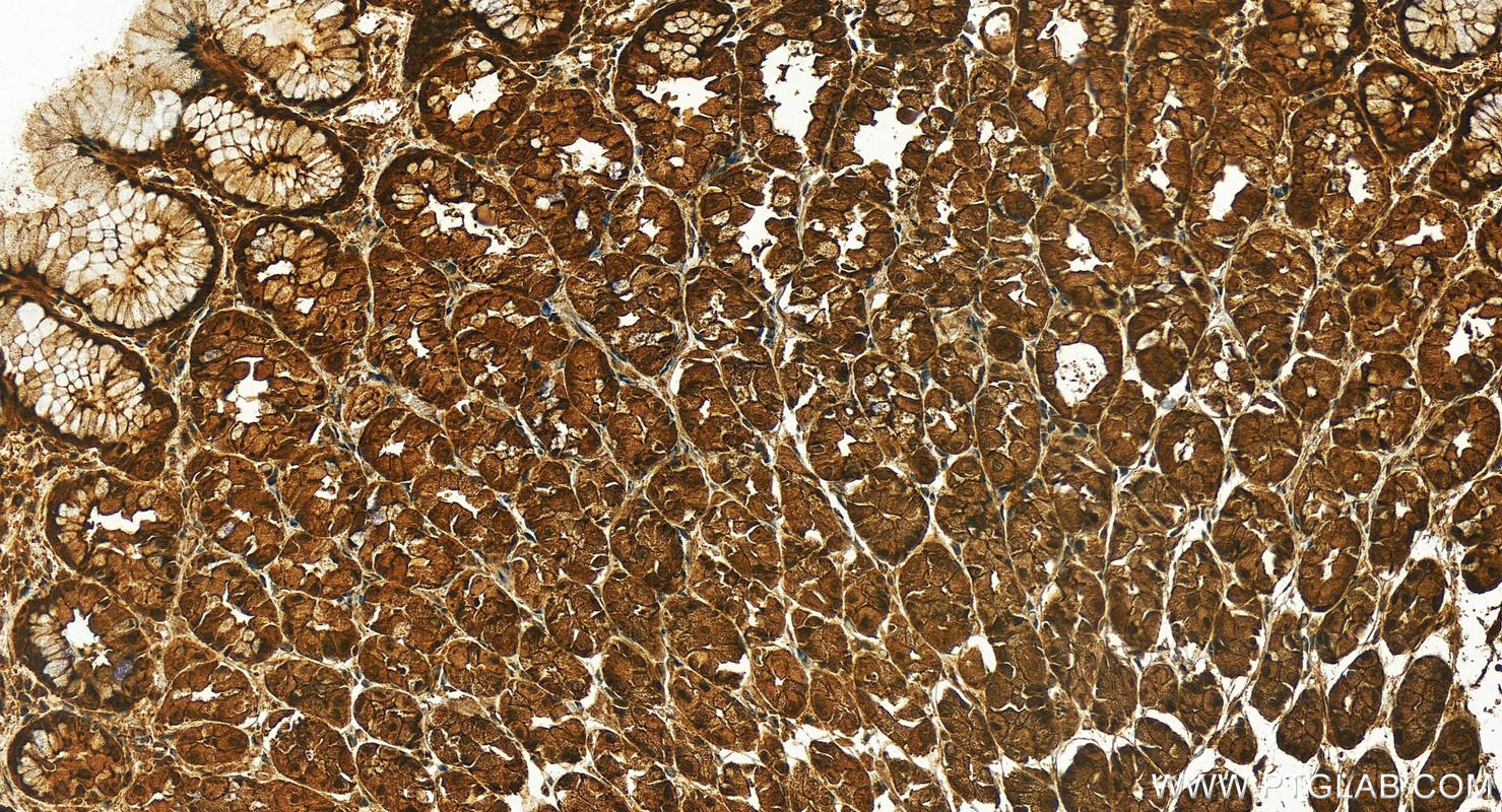 IHC staining of human stomach using 14608-1-AP