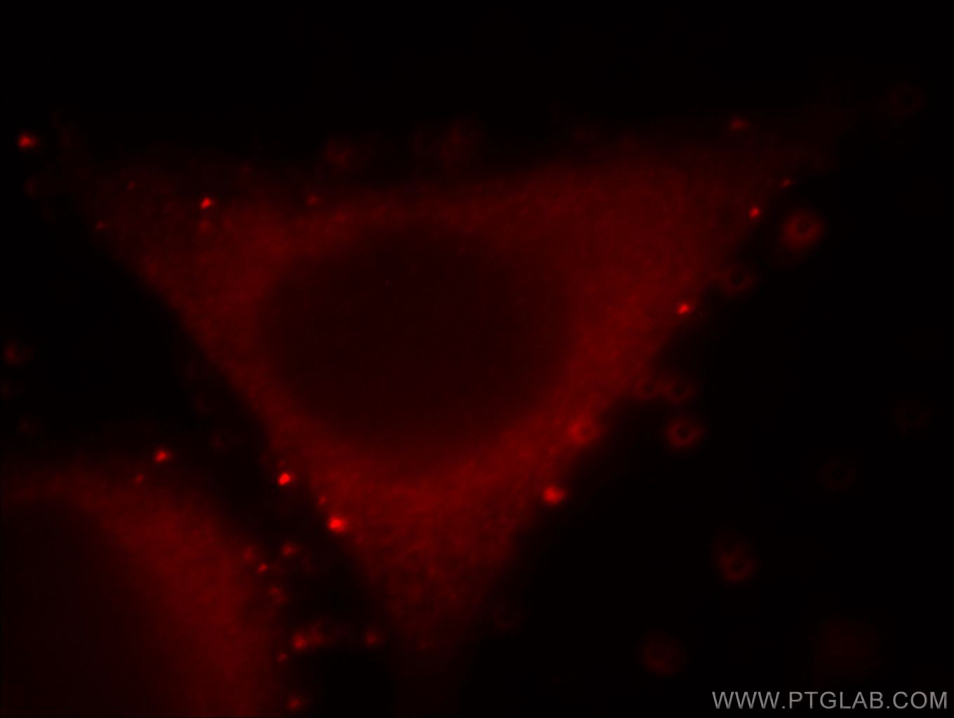 IF Staining of HepG2 using 14608-1-AP