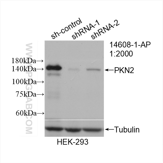 WB analysis of HEK-293 using 14608-1-AP