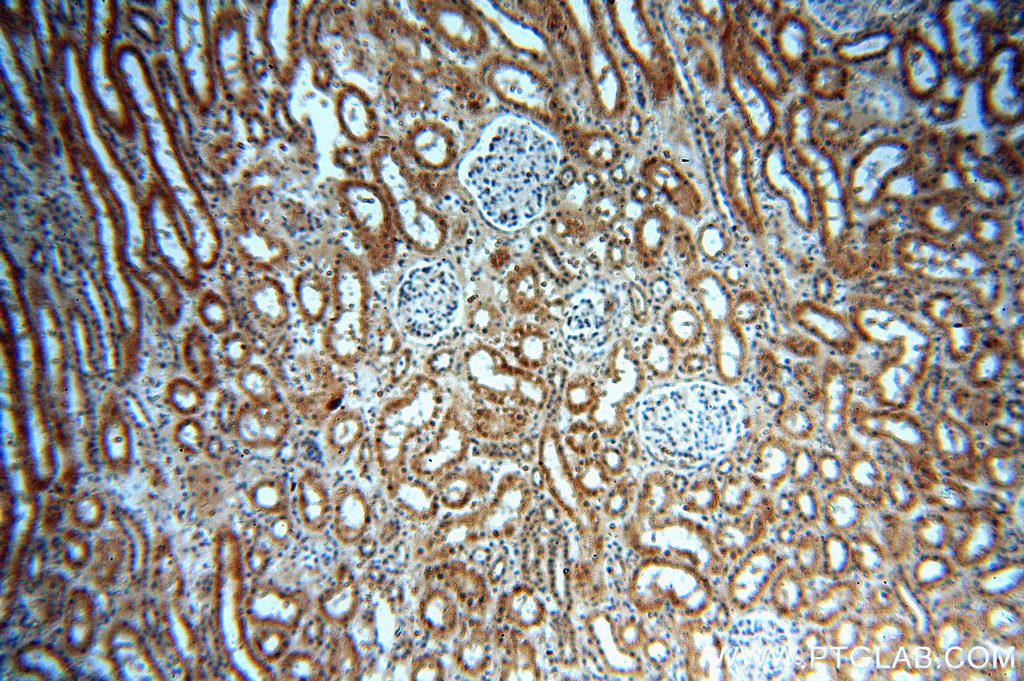 IHC staining of human kidney using 20352-1-AP