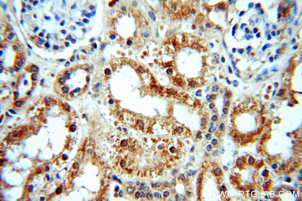 IHC staining of human kidney using 20352-1-AP