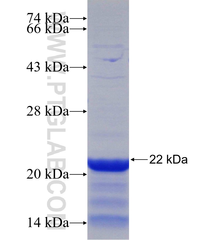 PKP2 fusion protein Ag30401 SDS-PAGE