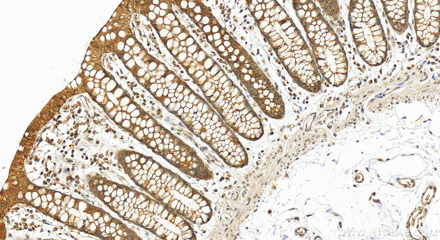 IHC staining of human colon using 18338-1-AP