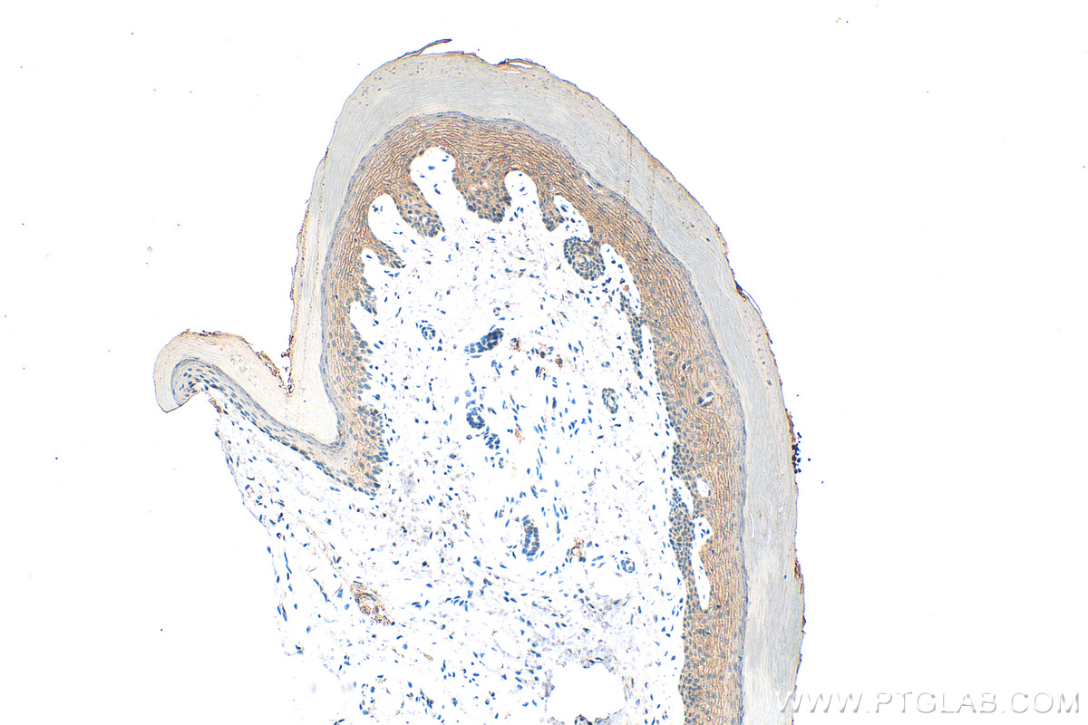 IHC staining of mouse skin using 18338-1-AP