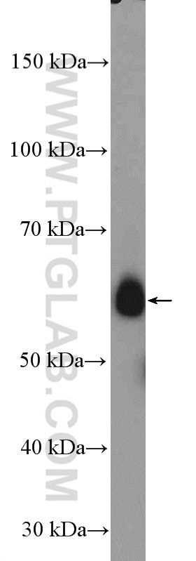 WB analysis of mouse spleen using 10863-2-AP