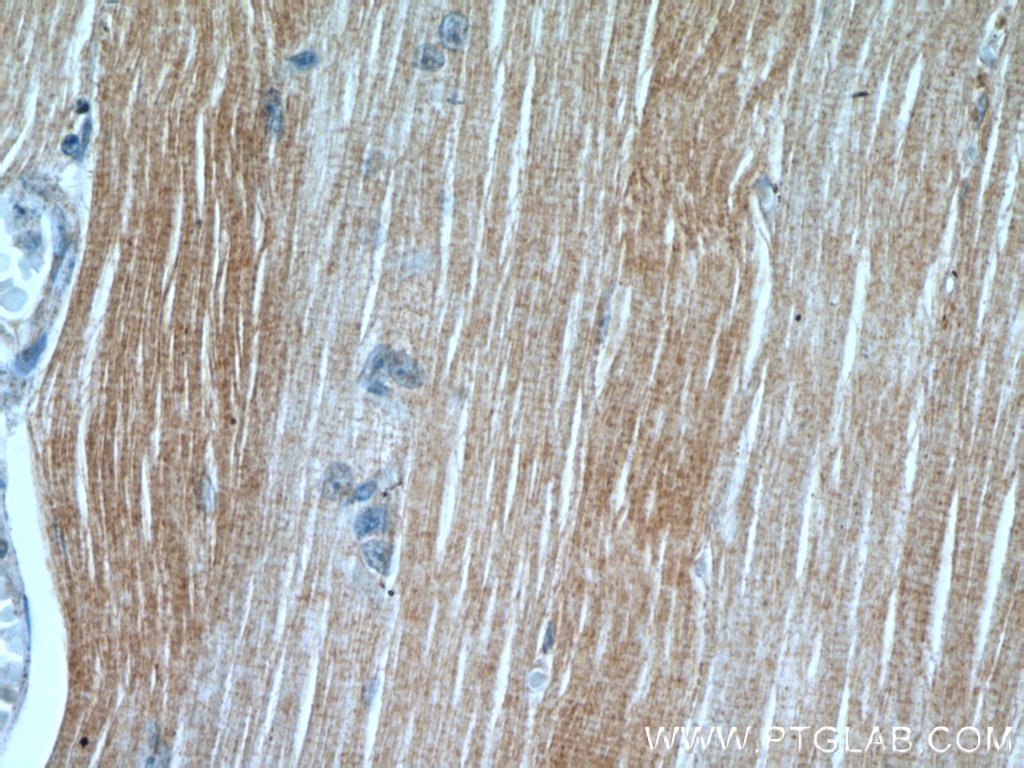 IHC staining of human skeletal muscle using 18088-1-AP