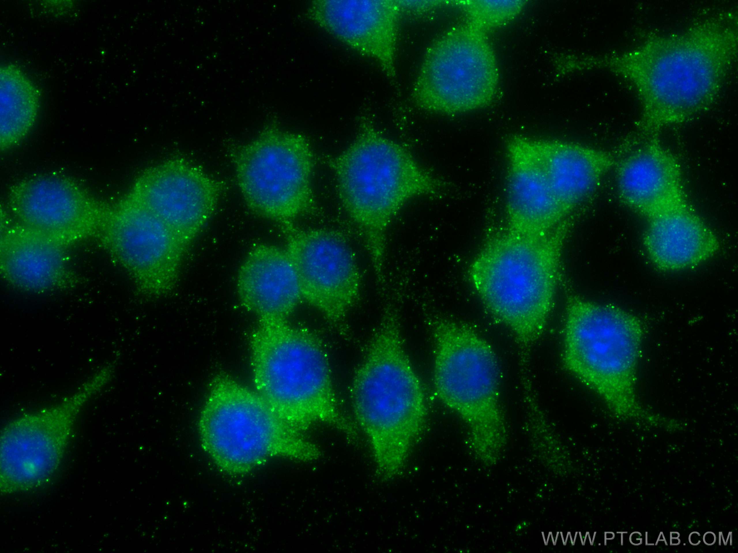 IF Staining of RAW 264.7 using 15526-1-AP