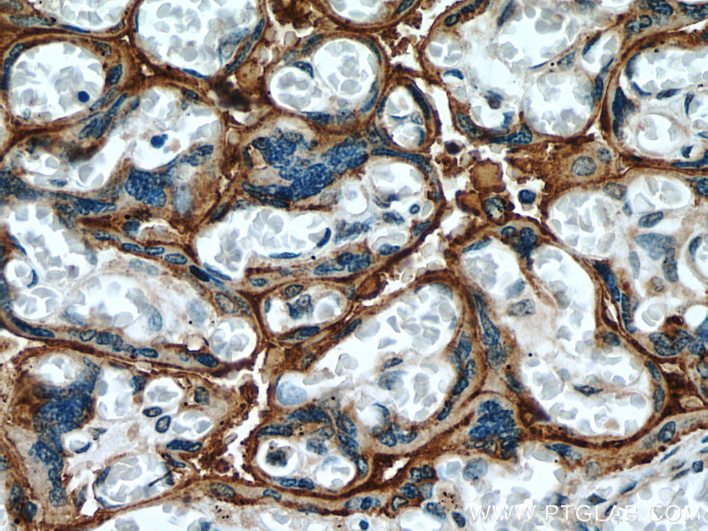 IHC staining of human placenta using 25435-1-AP