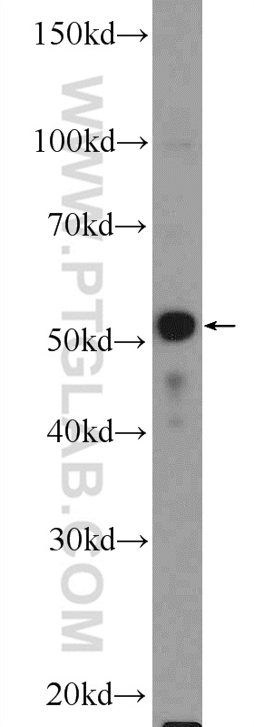 WB analysis of MCF-7 using 25864-1-AP