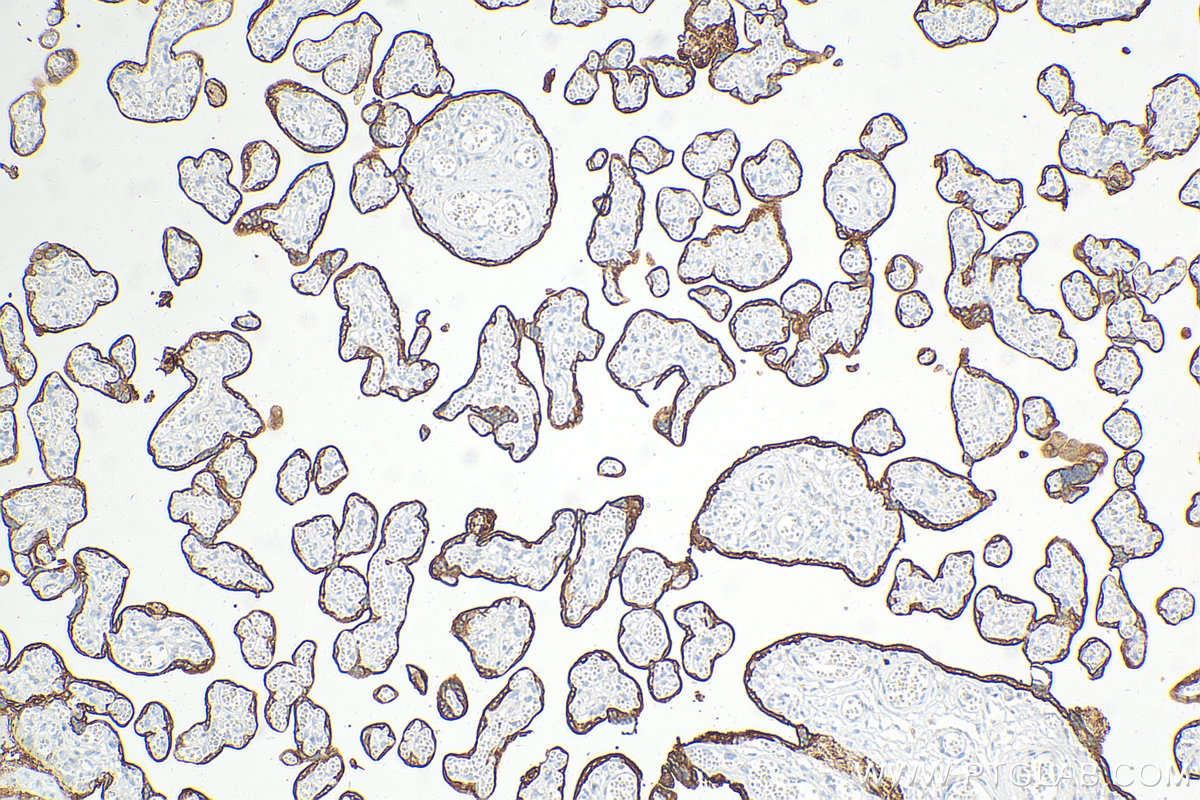 IHC staining of human placenta using 60294-1-Ig (same clone as 60294-1-PBS)