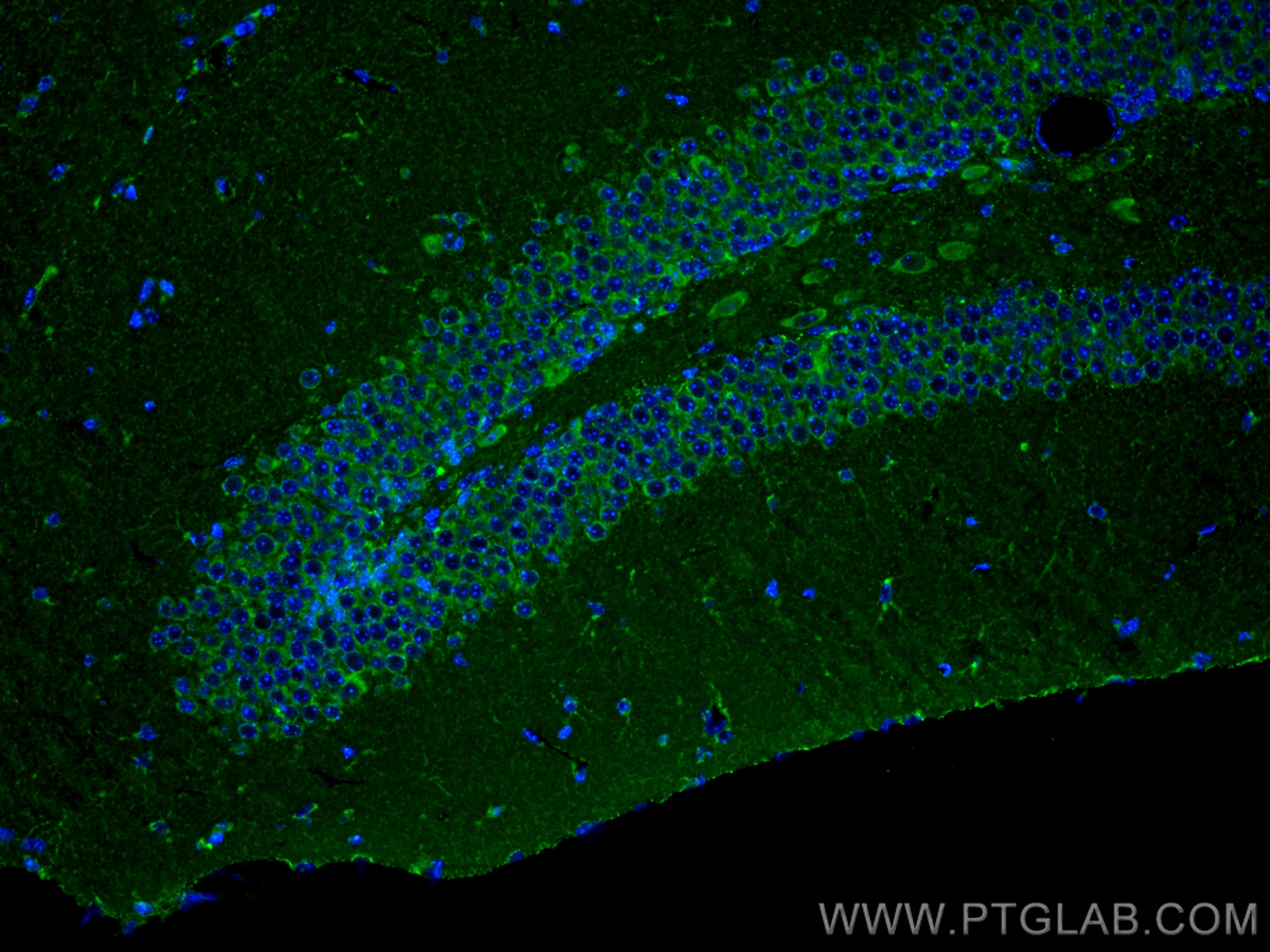 IF Staining of mouse brain using 10147-1-AP