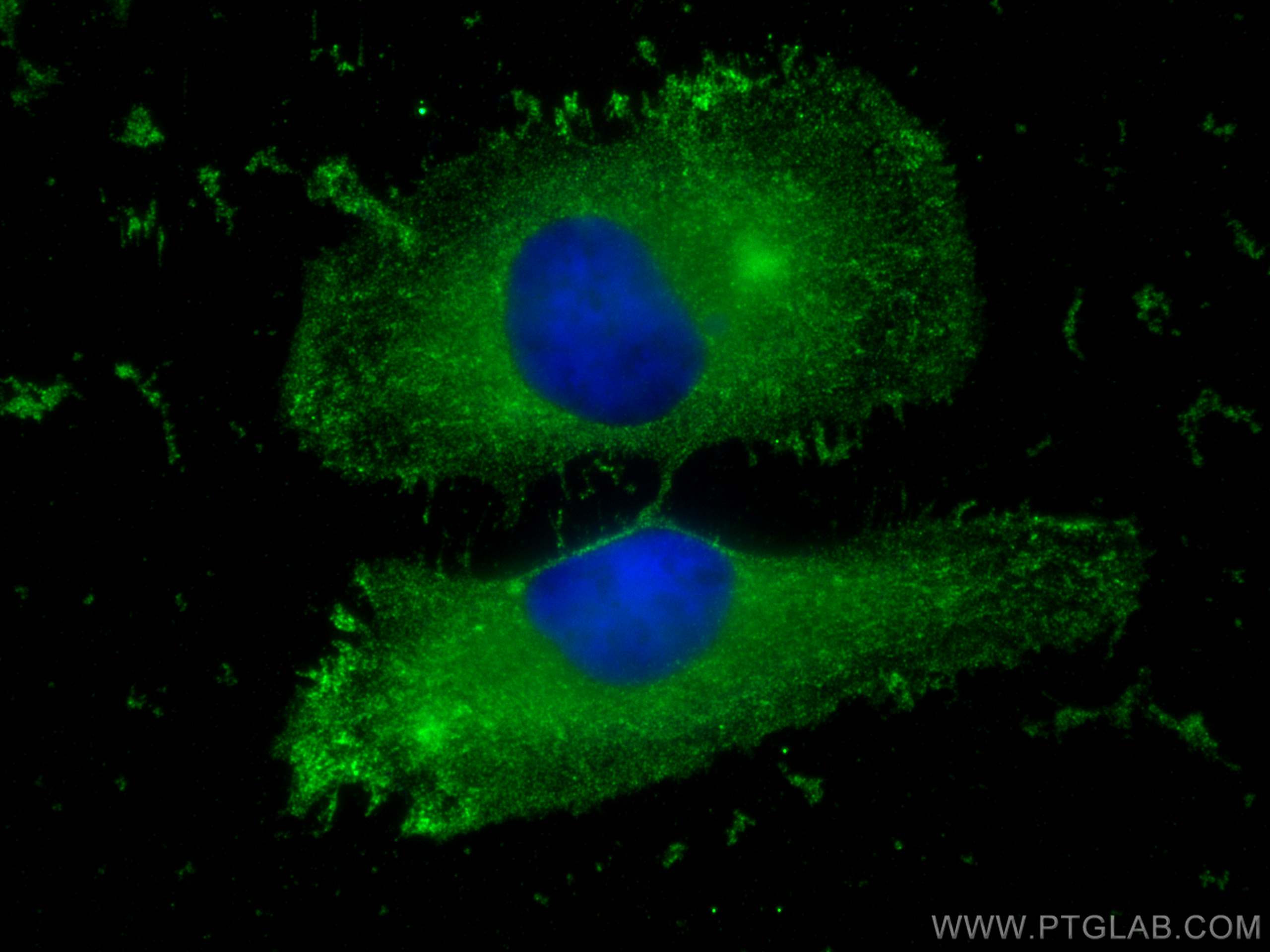 IF Staining of HeLa using 17968-1-AP