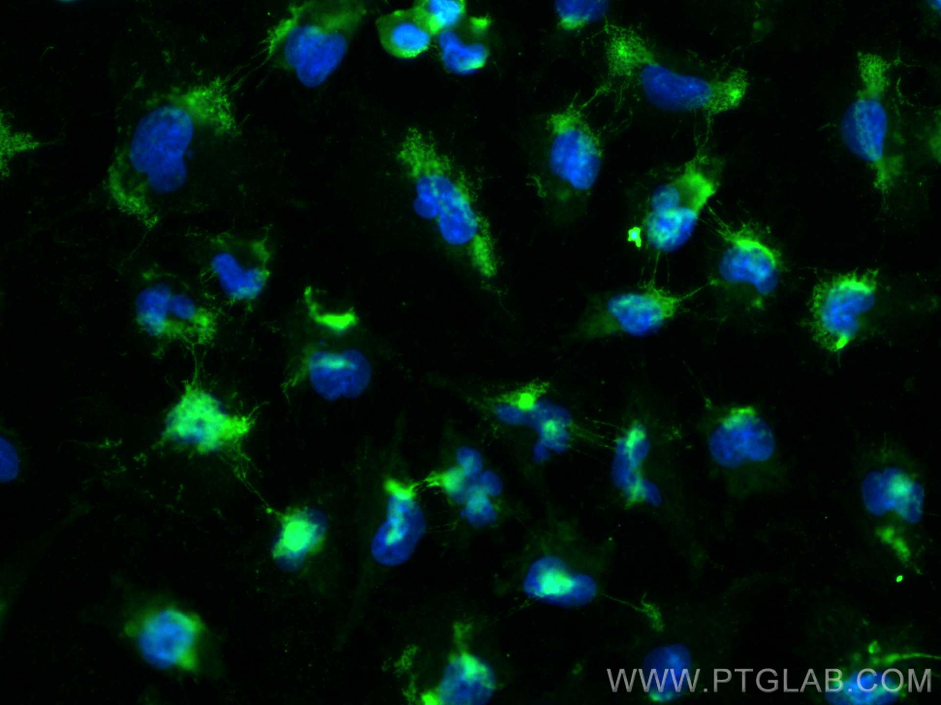 IF Staining of U-251 using 10286-1-AP