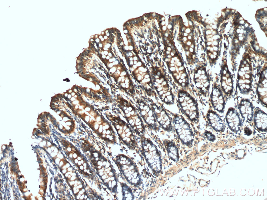 IHC staining of human colon using 21370-1-AP
