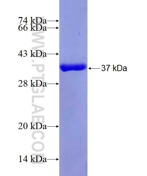 PLCD4 fusion protein Ag28900 SDS-PAGE