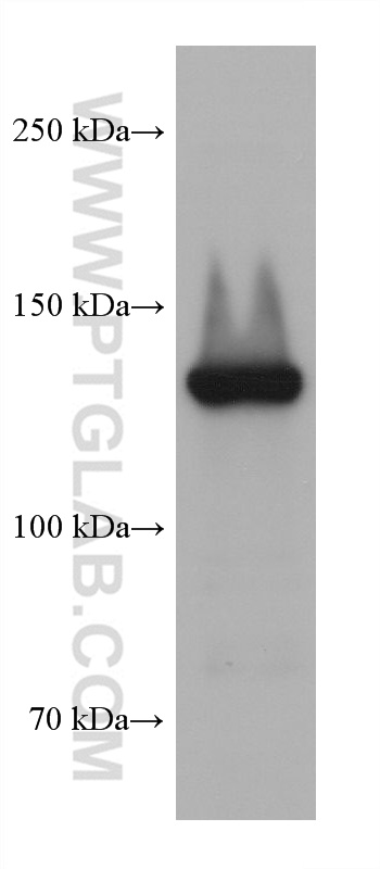 WB analysis of Karpas-422 using 67011-1-Ig