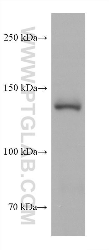 WB analysis of rabbit spleen using 67011-1-Ig