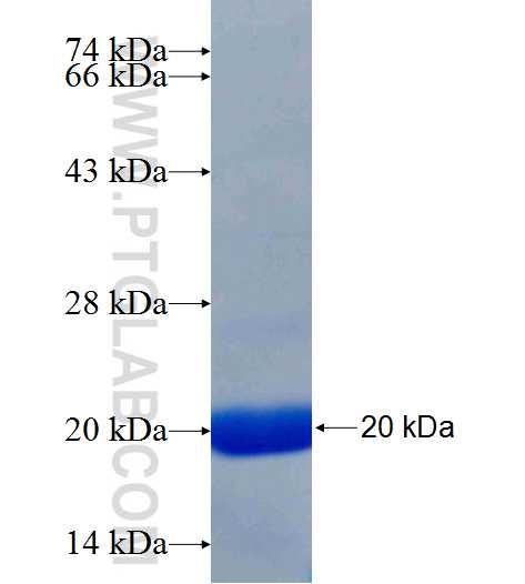PLCG2 fusion protein Ag26079 SDS-PAGE