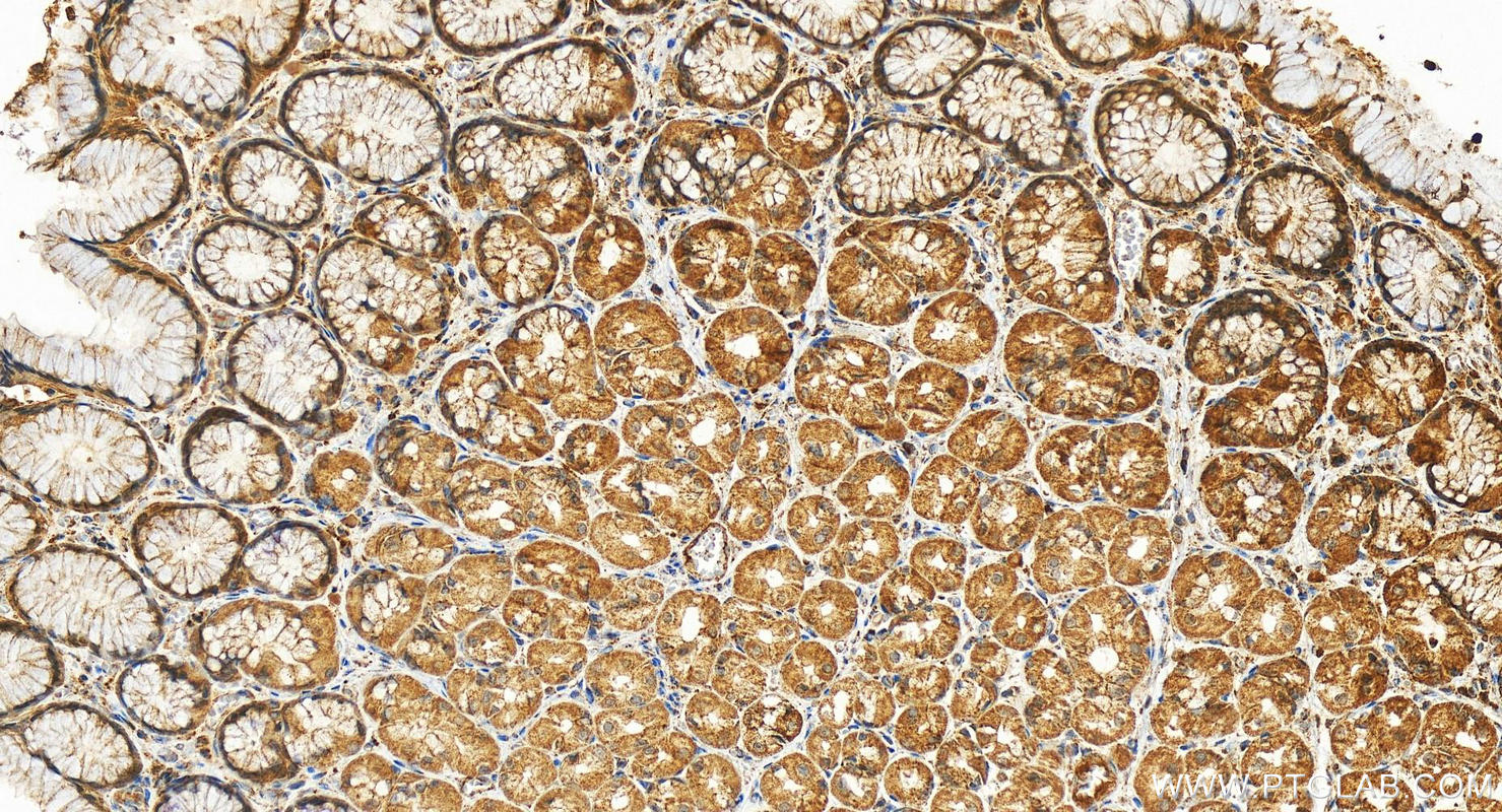 IHC staining of human stomach using 17327-1-AP