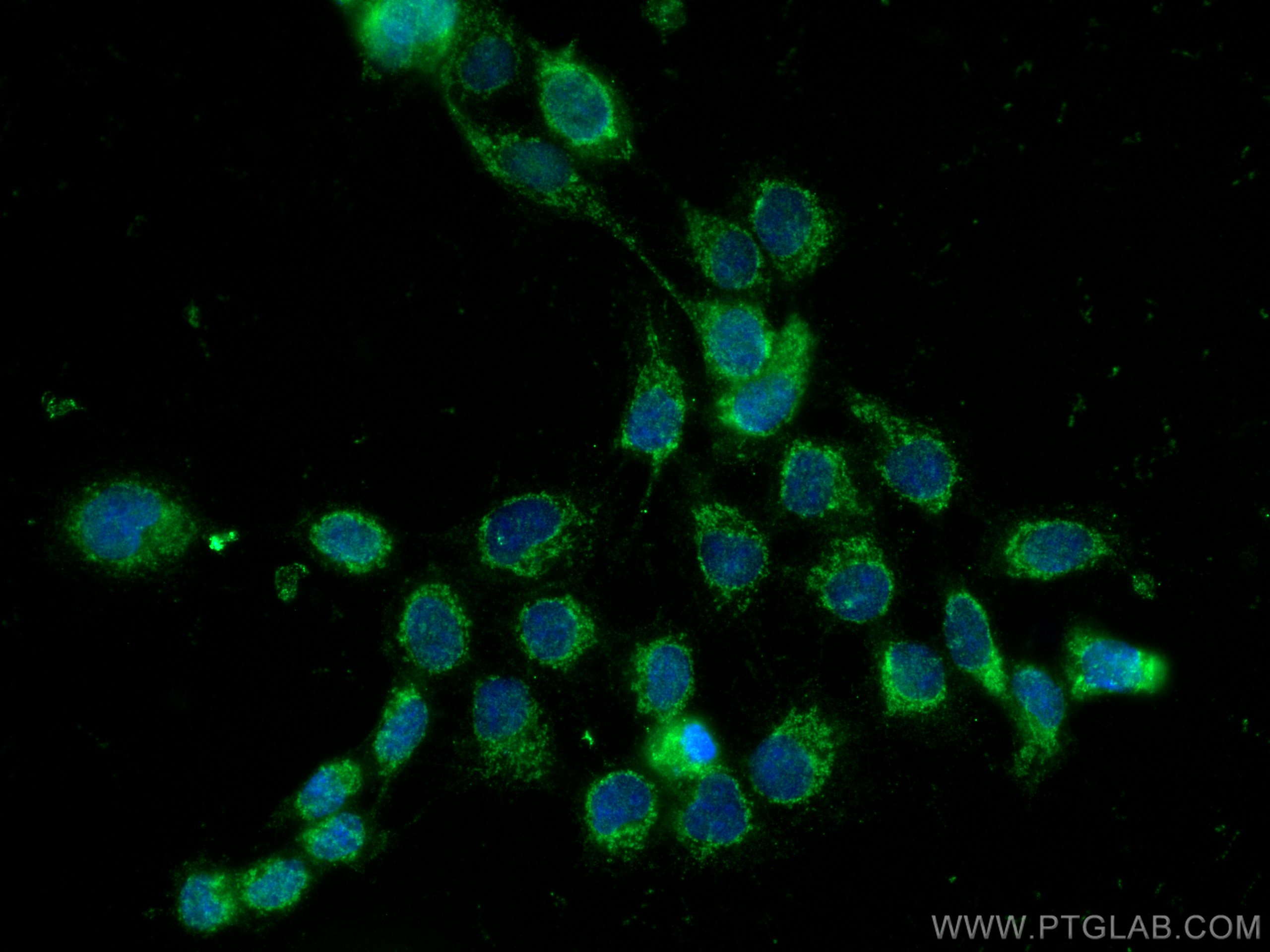 IF Staining of A431 using 17327-1-AP