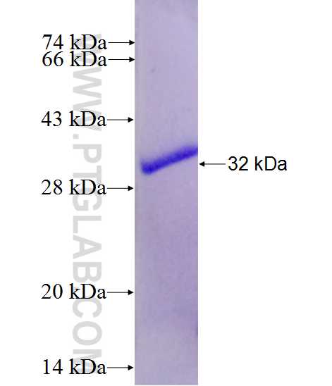 PLD5 fusion protein Ag26919 SDS-PAGE