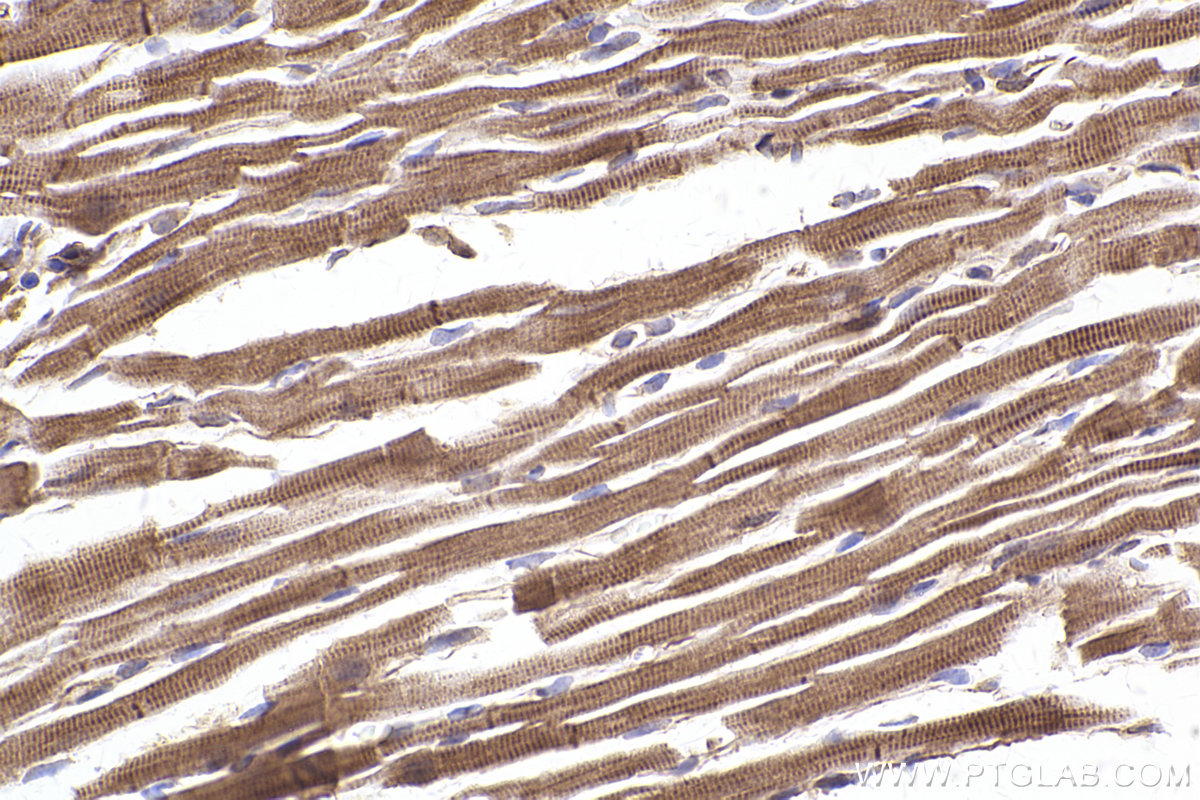 IHC staining of mouse heart using 29170-1-AP