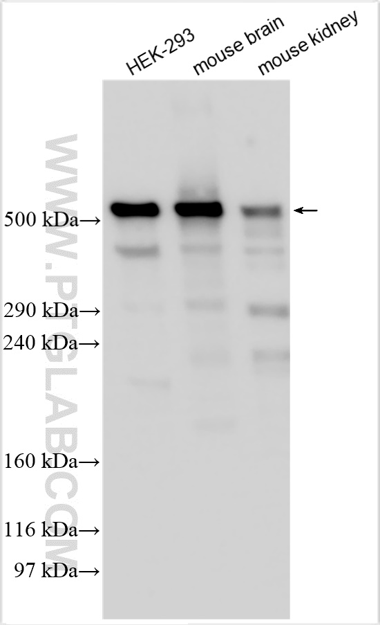 WB analysis using 29170-1-AP