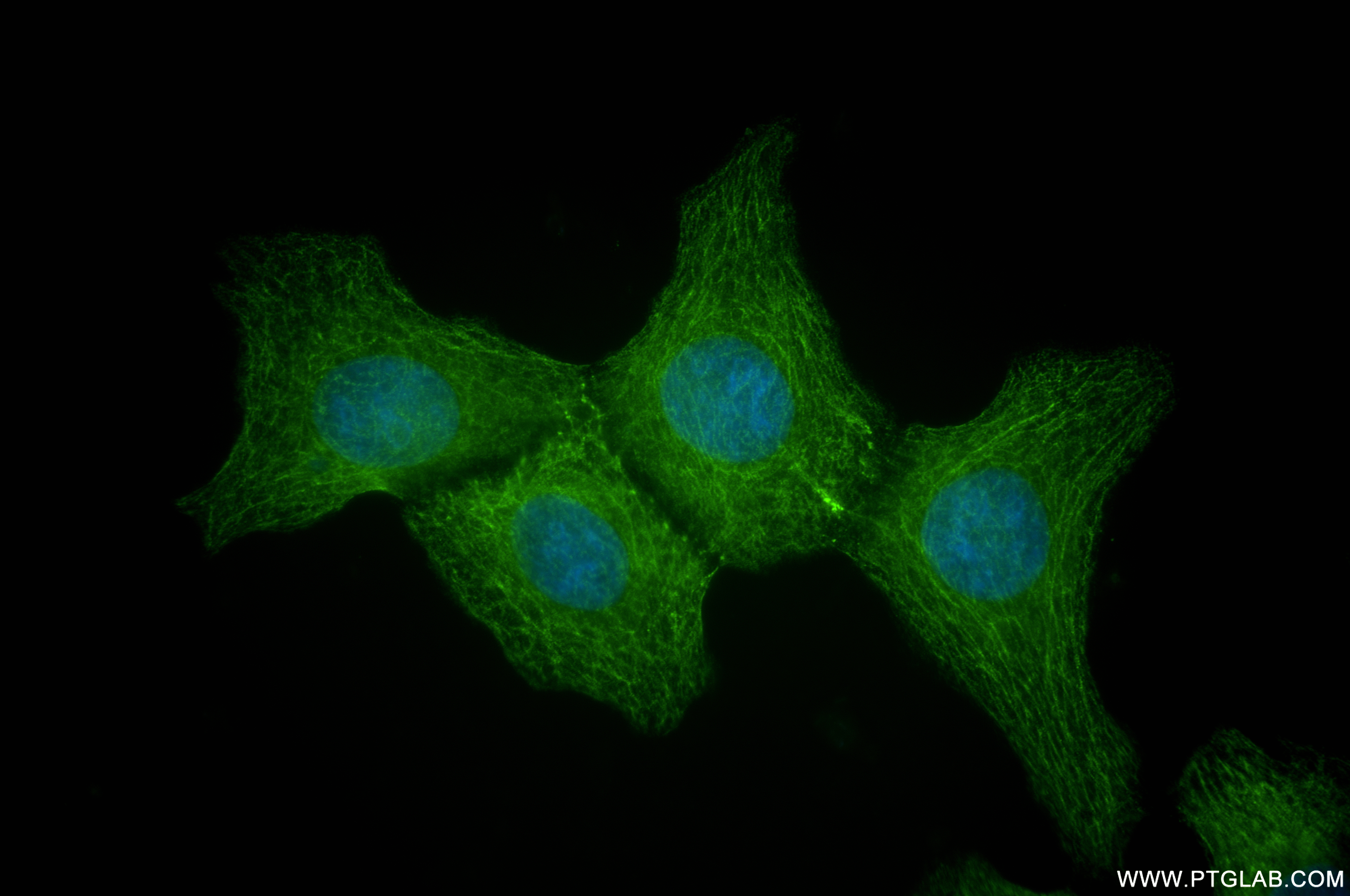 IF Staining of A431 using 83898-1-RR (same clone as 83898-1-PBS)