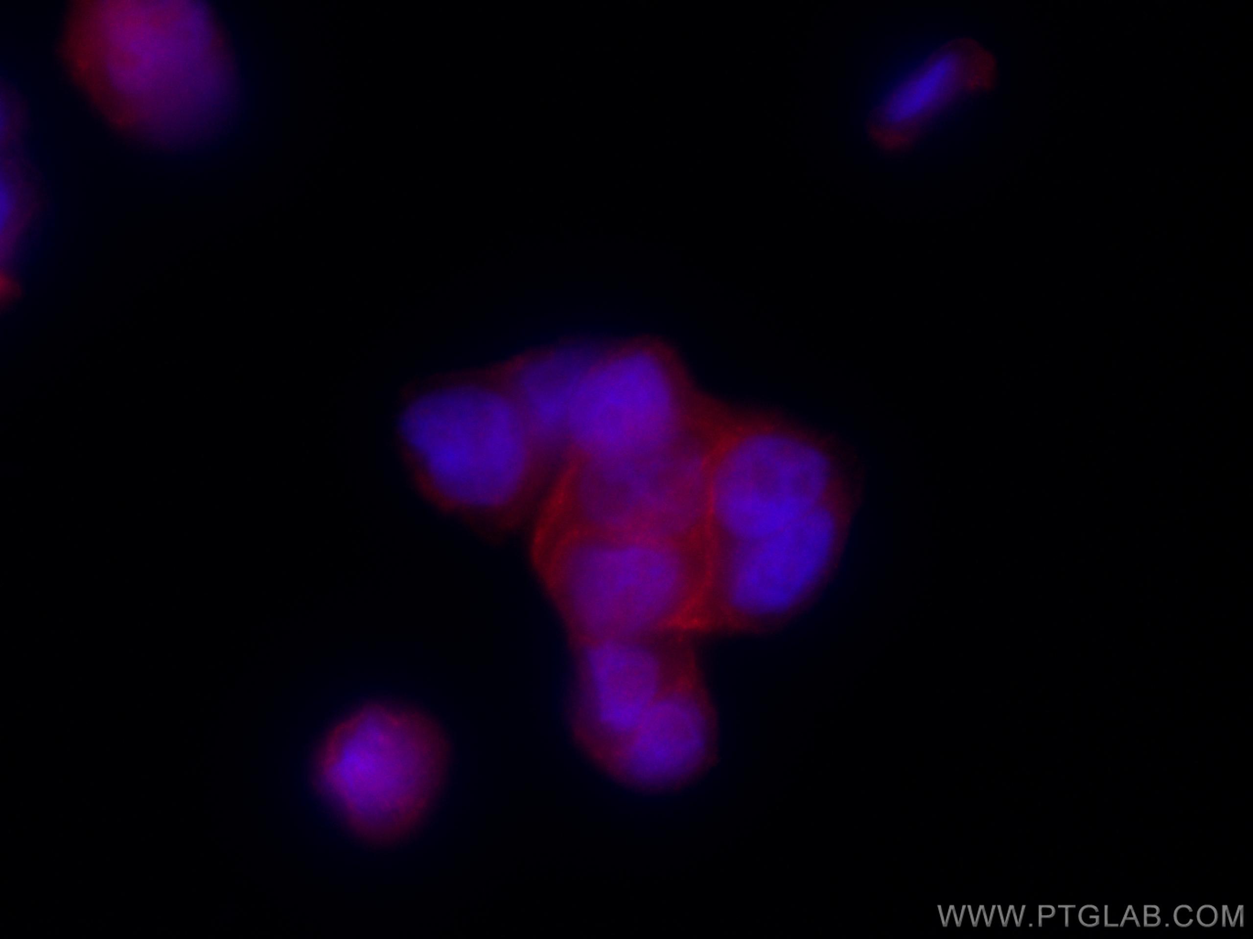 IF Staining of HT-29 using CL594-11685