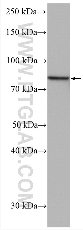 WB analysis of LNCaP using 28154-1-AP